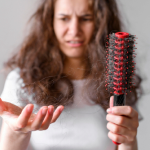 HAIRLOSS
